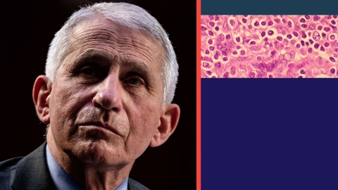 Anthony Fauci
